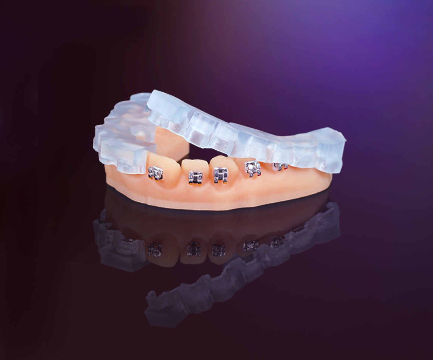 Keyprint Keyortho IBT